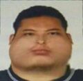 腮腺炎